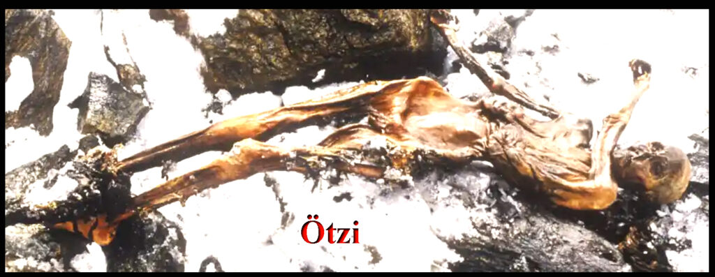 Ötzi